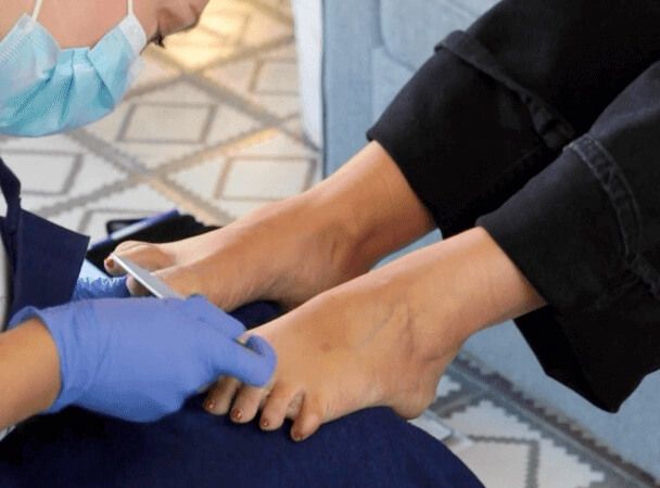 pedicura-bcn-3-608x450-2